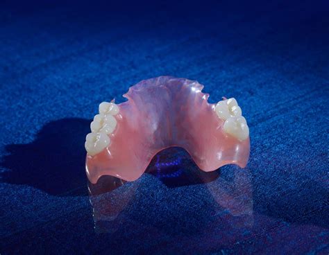 Cast metal <b>partials</b> are thin, strong, and clasp to teeth firmly. . Valplast partial dentures problems
